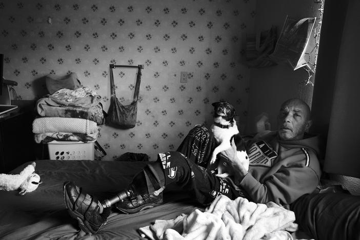 Tony Johnson sits on his bed with his dog, Dash, in the one-room home he shares with his wife, Karen Johnson, in a care facility in Burlington, Wash. on April 13, 2022. Johnson was one of the first people to get COVID-19 in Washington state in April of 2020. His left leg had to be amputated due to lack of wound care after he developed blood clots in his feet while on a ventilator.