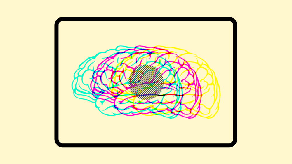 A graphic illustration depicting overlapping drawings of a brain.