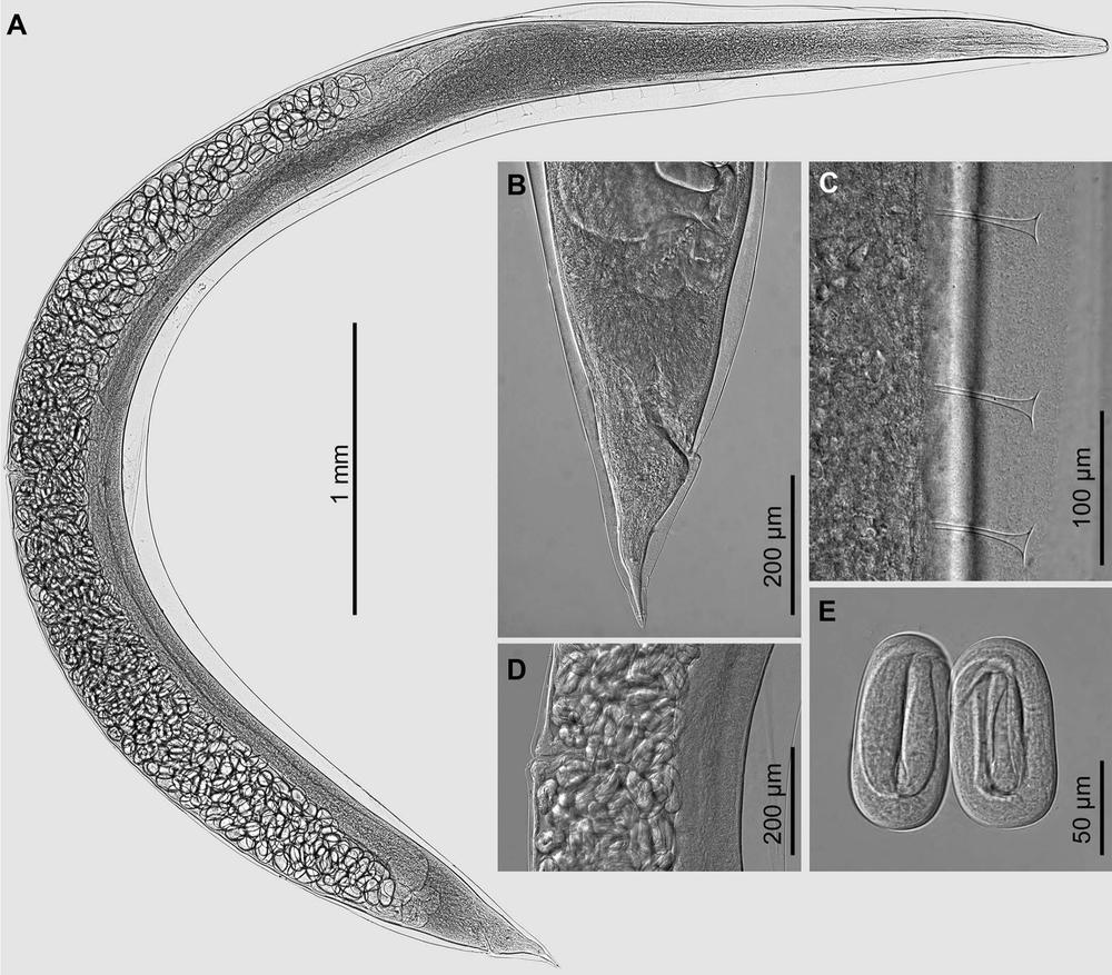 Rhabdias Conni, the parasitic worm species found in the lungs of frogs. Courtesy of Professor David Bruce Conn