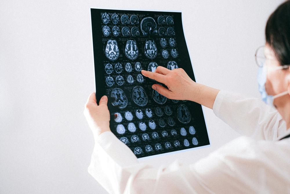 A person in a white coat and wearing a surgical mask points to brain scan results