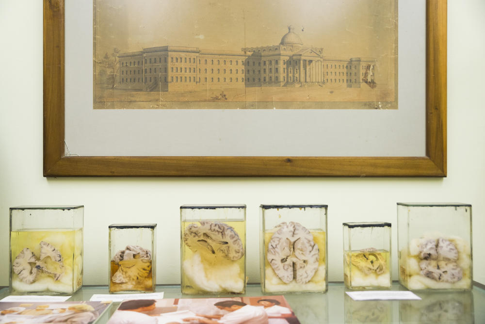 Lobotomized brains below a drawing of the Powell Building at Central State Hospital inside the hospital museum. 