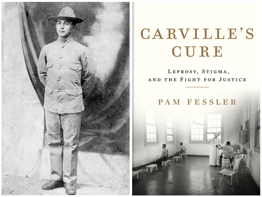Morris Koll, grandfather of NPR correspondent Pam Fessler's husband, enlisted in the U.S. Army and was sent to the Philippines in 1902. That's when he contracted leprosy. In 1935, public health authorities took him to the national leprosarium in Carville, La. Right: A treatment room at the facility is depicted on the cover of Fessler's new book, <em>Carville's Cure.</em>