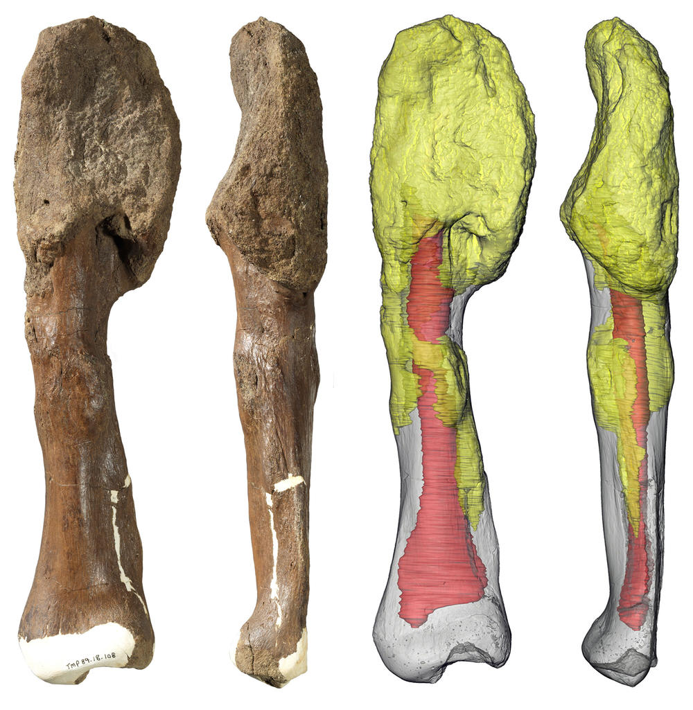 Two views of the <em>Centrosaurus apertus</em> shin bone (fibula) with malignant bone cancer (osteosarcoma). The extensive invasion of the cancer throughout the bone (yellow) suggests that it persisted for a considerable period of the dinosaur's life and may have spread to other parts of the body prior to death.