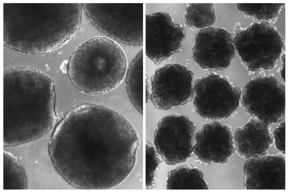 Compared with brain organoids grown from ordinary human cells (left), the organoids with the Neanderthal gene variant have a rough outer layer.