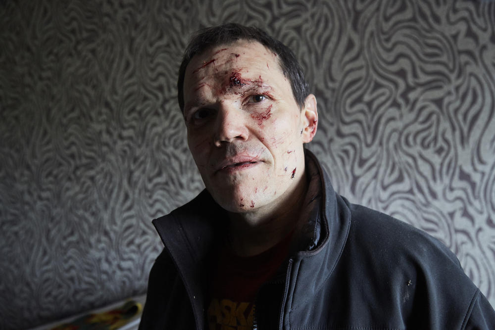 Vladimir collects belongings in his bedroom damaged by a missile on February 25, 2022 in Kyiv, Ukraine. Vladimir was wounded on his face by an exploding window.