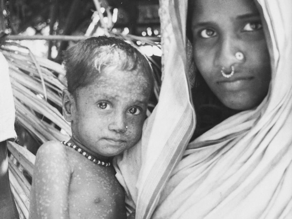 Rahima Banu, pictured with her mother in Bangladesh in 1975, is recorded as having the last known naturally-occurring case of the deadly form of smallpox.