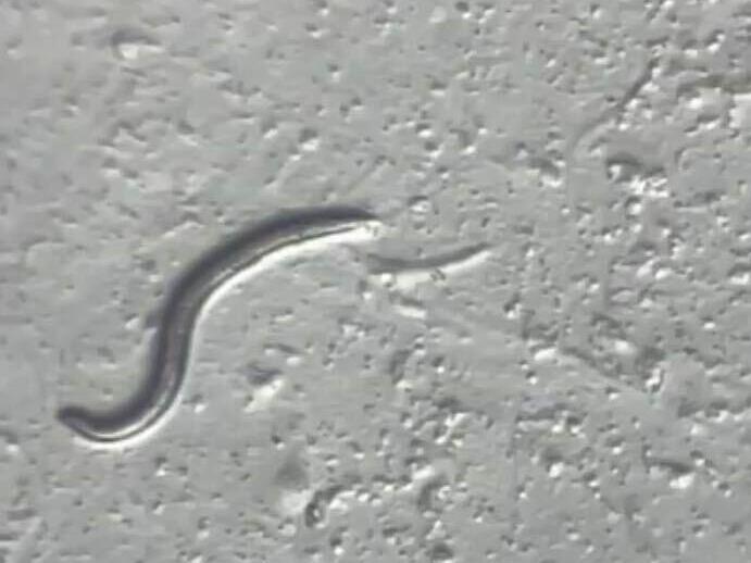 A <em>Panagrolaimus kolymaensis </em>nematode is seen under the microscope at the University of Cologne's worm lab in Germany.