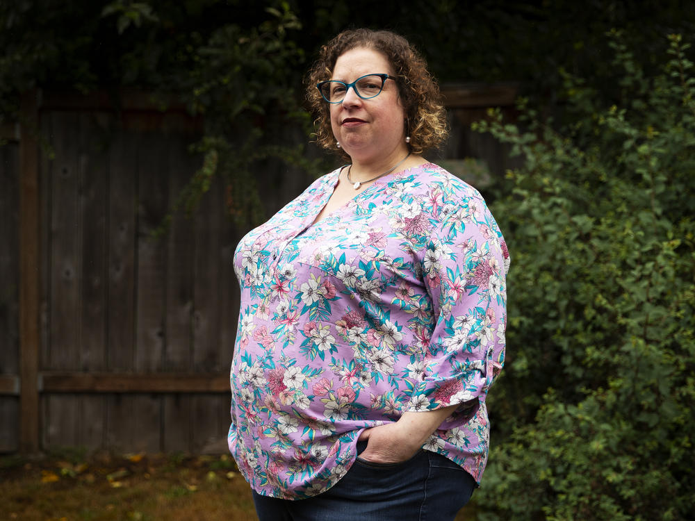 When Sarah Barak, standing here outside her Seattle home, needed an operation for her injured thumb, her surgeon gave her unsolicited advice to lose weight. People with larger bodies often report that when they go to the doctor, their problems are ignored or written off as an inevitable result of their weight.