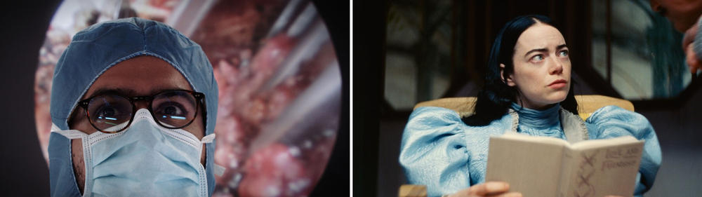 A surgeon in <em>De Humani Corporis Fabrica</em>, left, and Emma Stone in <em>Poor Things.</em>