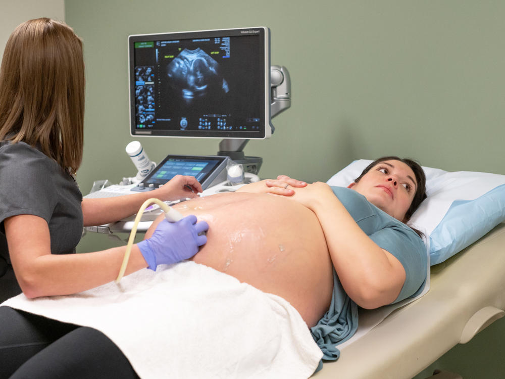 Kelsey Hatcher, right, and University of Alabama at Birmingham ultrasound supervisor, Niki Marsh, left. Hatcher didn't know she was having twins until the ultrasound showed a second fetus in a separate uterus.
