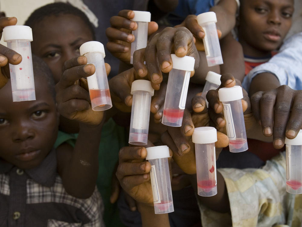 Children in Nasarawa, Nigeria, hold samples of their urine specimens. Blood in the urine is a sign of Schistosomiasis, a microscopic worm that, left untreated, can damage organs as well as cause learning delays. A new pill has been developed to treat preschoolers.