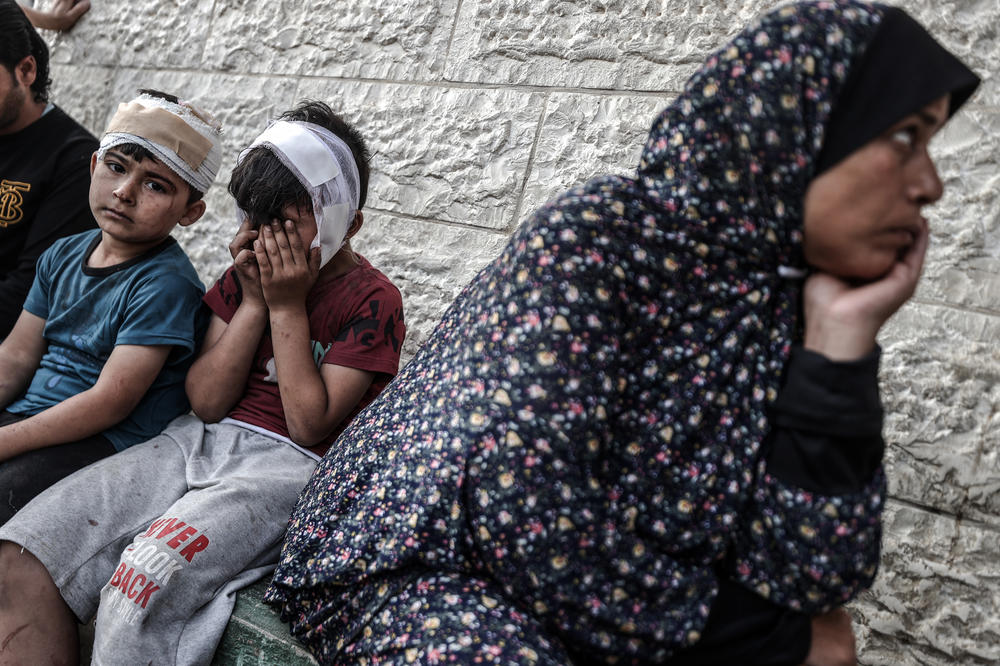Two wounded children are seen with bandages on their heads after being brought for treatment at Shuhada al-Aqsa Hospital after an Israeli attack hit the Maghazi camp area in Deir al-Balah, Gaza, on May 11.