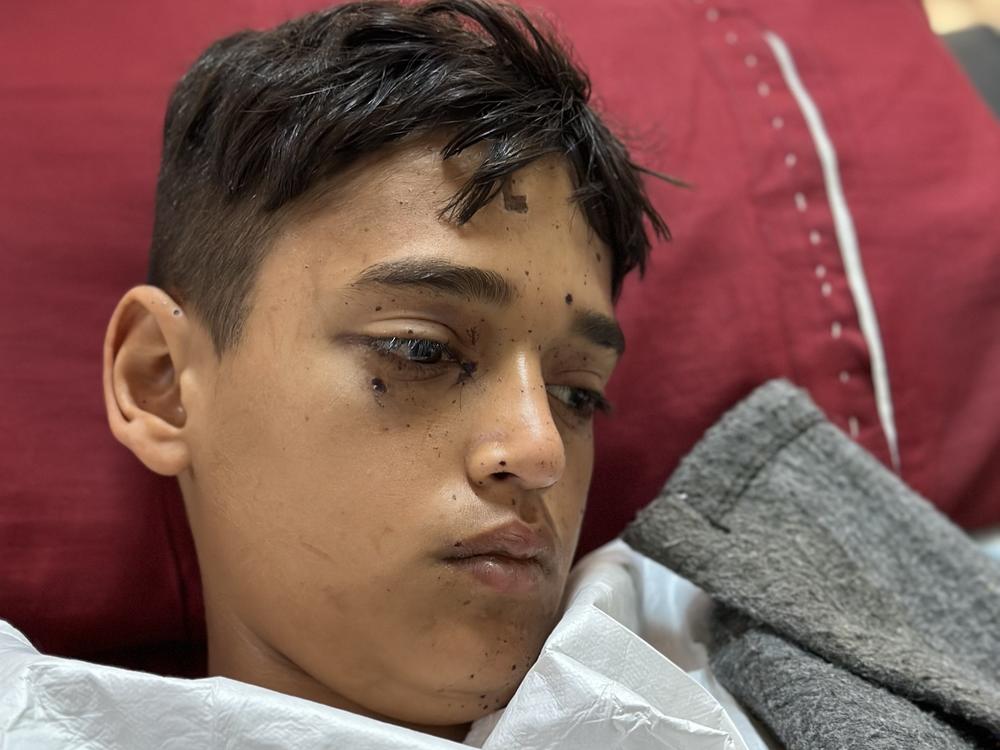 Fourteen-year-old Mohammed Abu Samur found what he thought was a bottle of perfume or deodorant. He lost his left hand below the elbow, and all the fingers on his right hand.