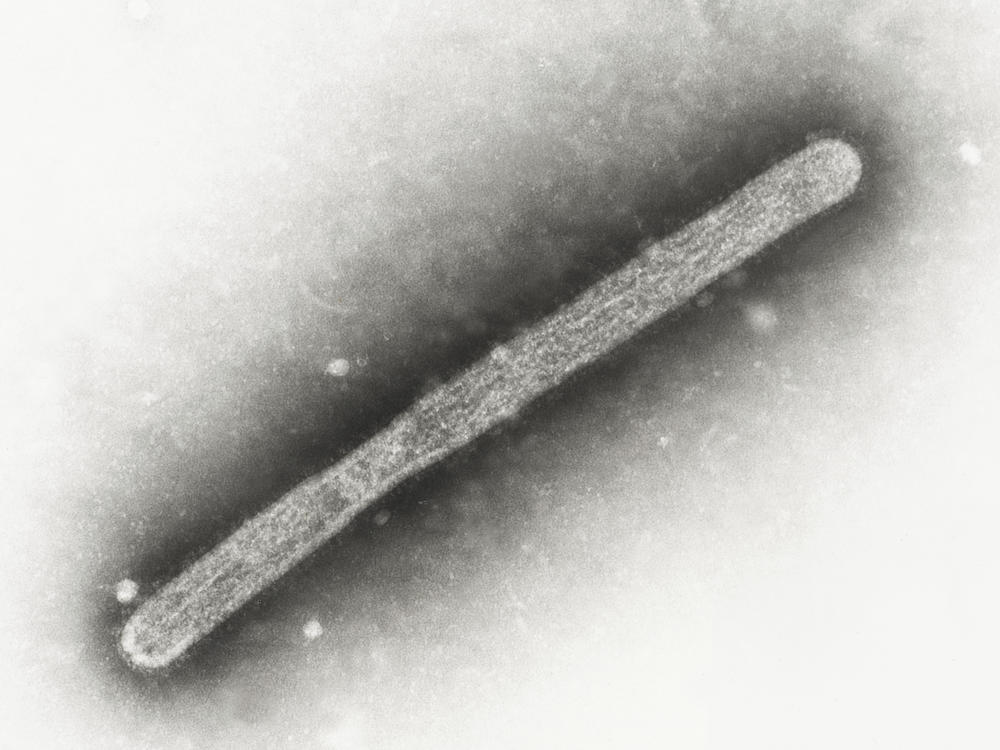 This 2005 electron microscope image shows an avian influenza A H5N1 virion. On Wednesday, Michigan health officials said a farmworker has been diagnosed with bird flu, the second human case connected to an outbreak in U.S. dairy cows.