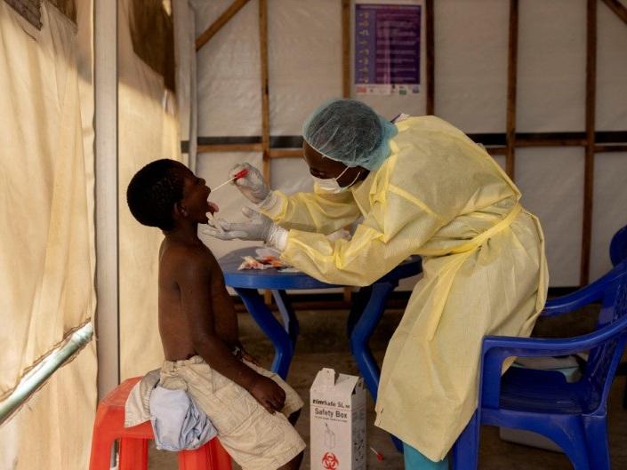 Nurse Christian Musema takes a sample from a child declared a suspected case mpox at the treatment center in Munigi in the Democratic Republic of Congo, where the virus has been surging. Cases have also been identified in four other countries in East Africa.