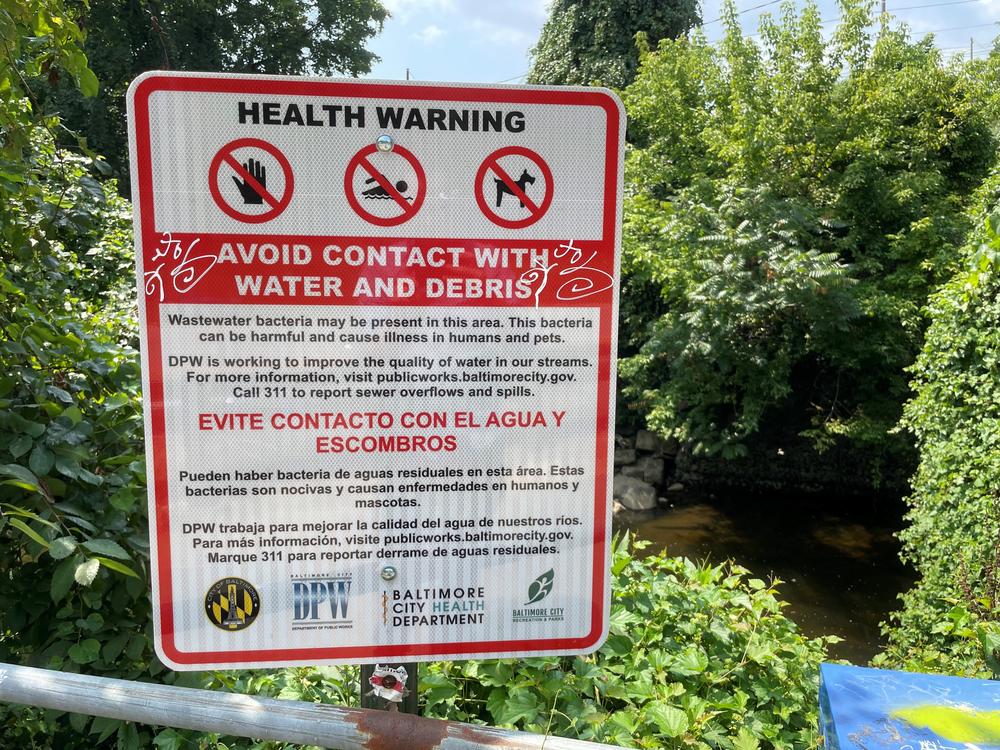  A sign above the Jones Falls in Baltimore warns people not to touch the water or debris.