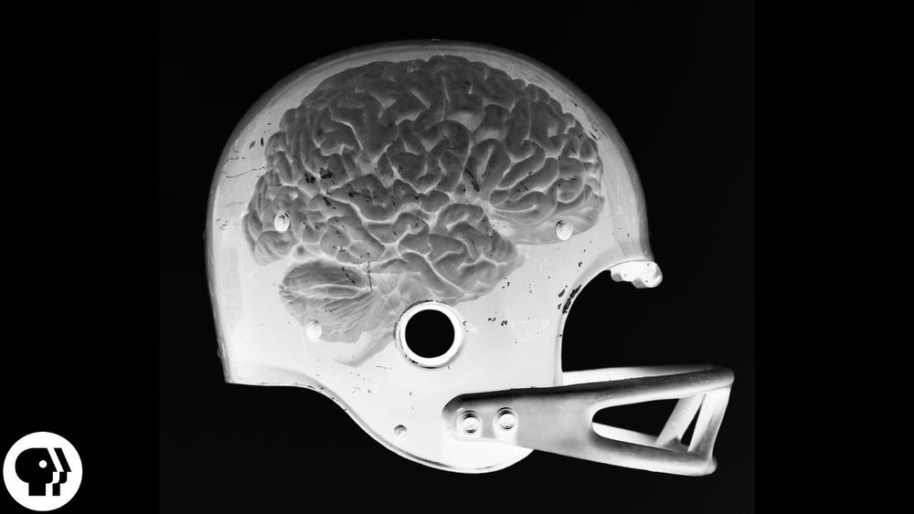 Are Concussions Deadly?: asset-mezzanine-16x9