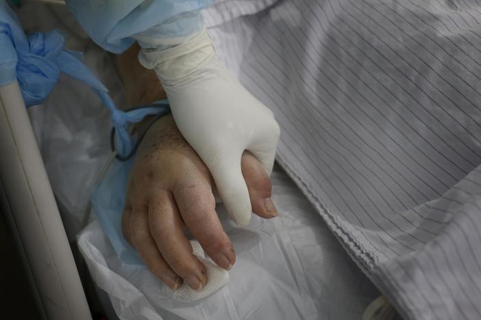 Nurse holds patients hand in the ICU.