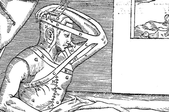 Thinking about getting a nose job? Thank goodness it's not the 16th century.