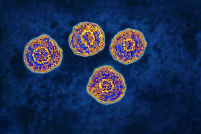 White House makes push to eradicate hepatitis C