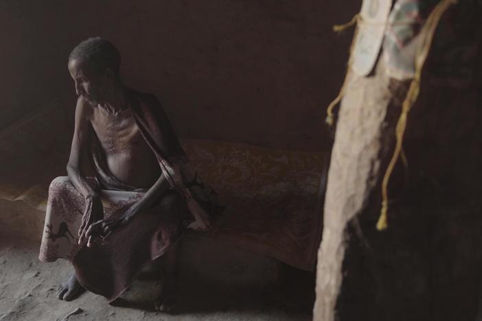 Conflict in Ethiopia eases, but millions there still face risk of starvation