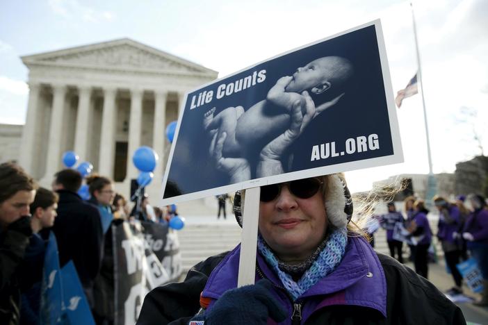Texas is using sovereign immunity to restrict abortions. Why is the Supreme Court silent?