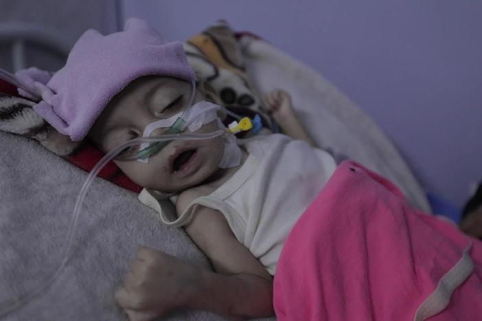 Stalked by death: How rising food insecurity is killing war-torn Yemen's children