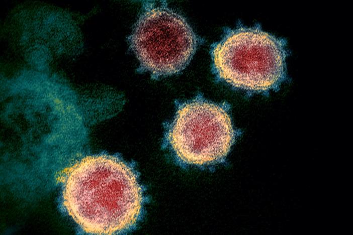 A virologist answers viewer questions about coronavirus transmission