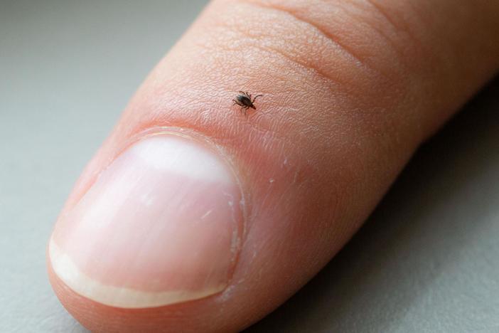 What more can be done to treat Lyme disease and its potential long-term effects