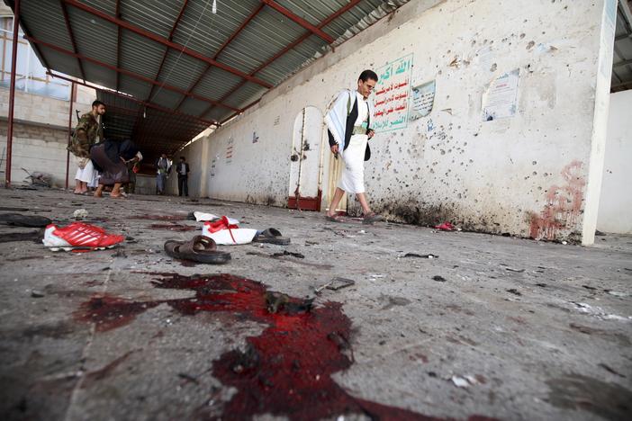 Yemen’s deadliest terror attack in decades left hundreds of casualties.