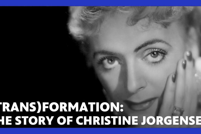 Christine Jorgensen was one of the first people to undergo gender affirmation surgery.