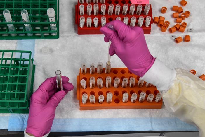 A lab technician sorts blood samples for a COVID-19 vaccination study at the Research Centers of America in Hollywood, Fla., on Aug. 13.