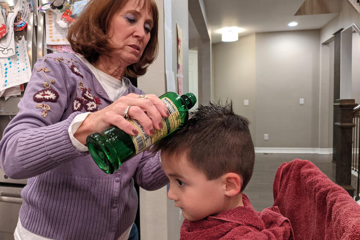 LiceDoctors technician Linda Holmes checks the heads of everyone in the Marker family for lice, including preschooler Hudson. It cost more than $200 to get the four-person household checked — eyebrows and Dad's beard included.