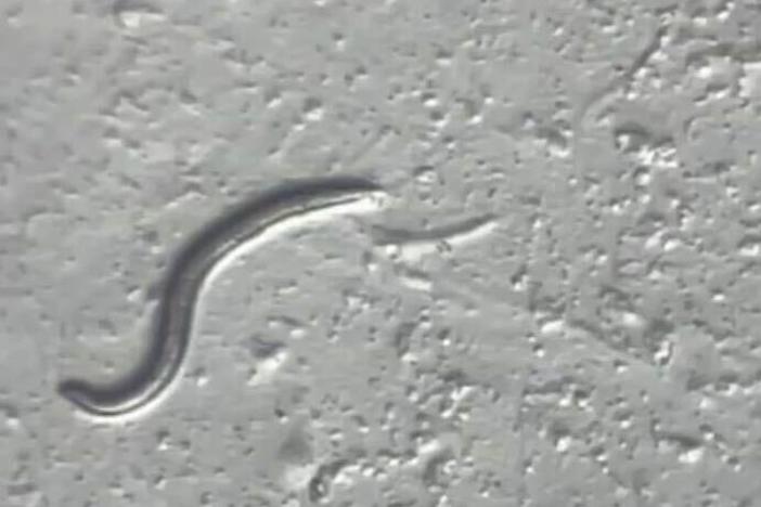 A <em>Panagrolaimus kolymaensis </em>nematode is seen under the microscope at the University of Cologne's worm lab in Germany.