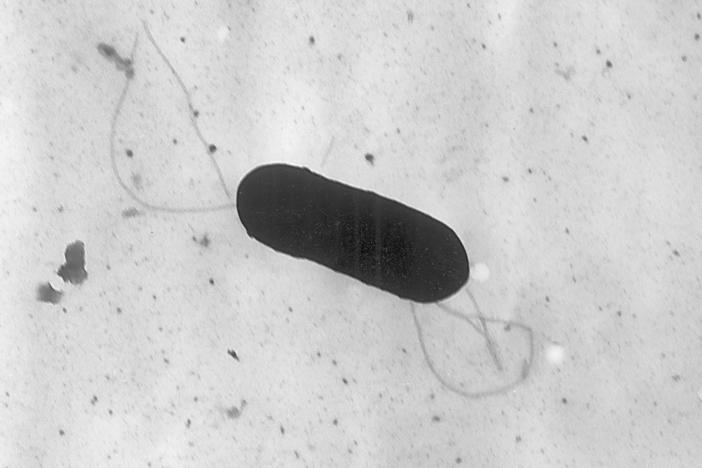 An electron microscope image of a Listeria monocytogenes bacterium, which has been linked to an outbreak spread through deli meat. Boar's Head recalled meat on Friday, after two deaths and 33 hospitalizations linked to Listeria.