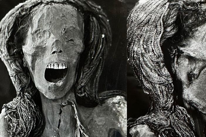 Photographs of the front and right profile of the head of the "Screaming Woman" mummy were taken in 1939 at the Kasr Al Ainy Faculty of Medicine in Cairo.