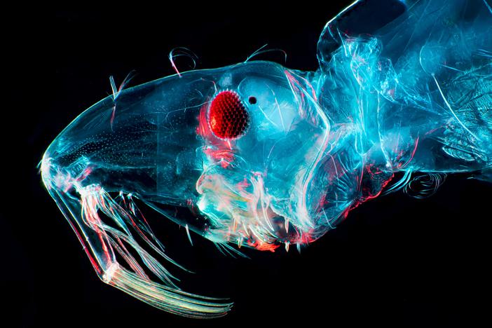 A magnification of the head of a midge larva. Midges — biting flies — and mosquitoes are spreading the Oropouche virus in Latin America, which is reporting higher numbers in 2024.