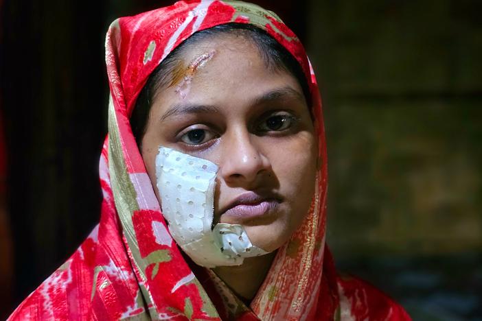 Raashida, 15, says she was injured in her family's home in Rakhine State, Myanmar, on August 7 in a drone attack by the Arakan Army. Her mother and one sibling also sustained injuries. According to Amnesty International, "Rohingya civilians are now caught in the middle of intensifying conflict in Rakhine State between the Arakan Army and the Myanmar military." Raashida's family has fled Myanmar for Bangladesh, where nearly 1 million Rohingya refugees live in camps, having left their homes due to anti-Musli…